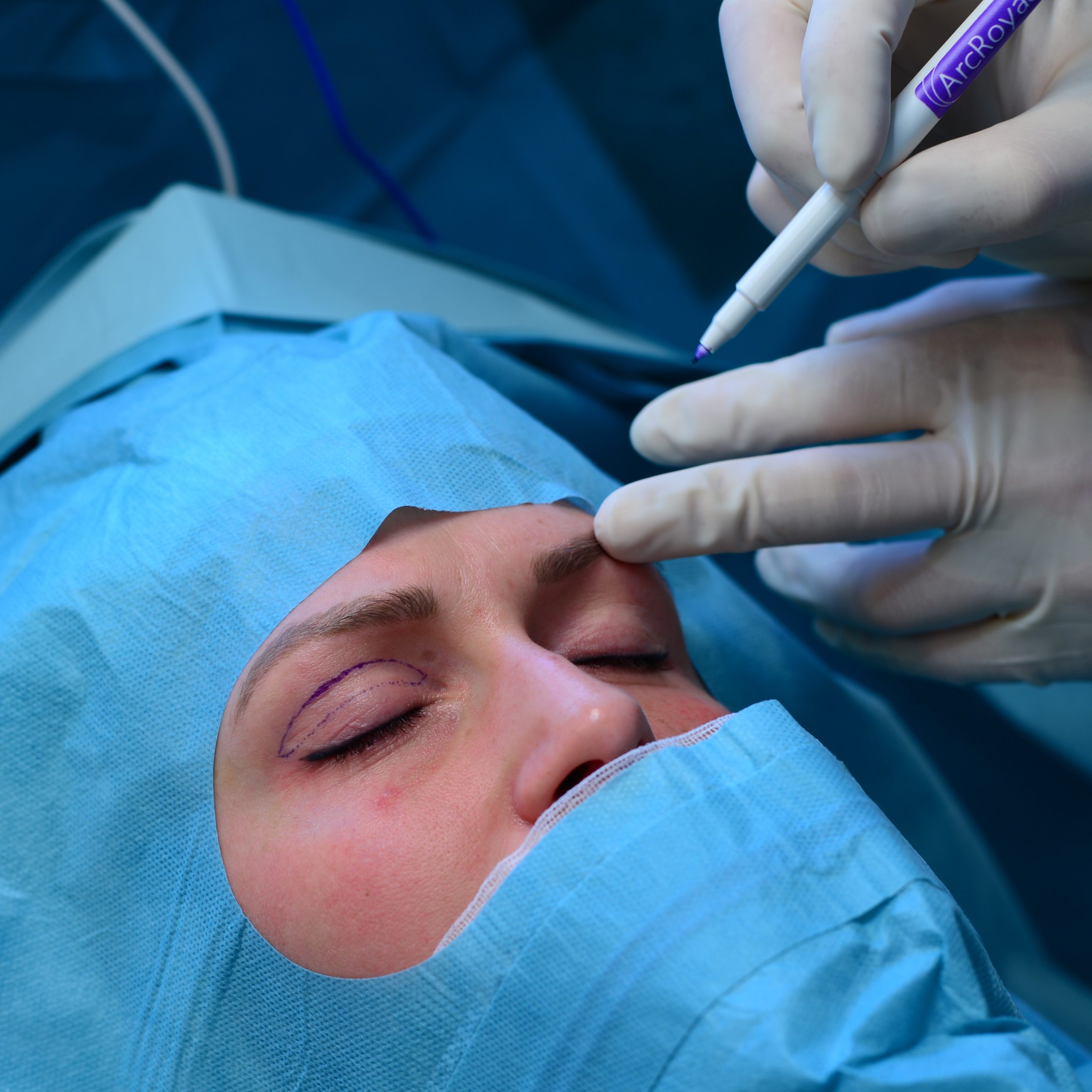 Frau bei einer Botox Behandlung